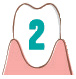 歯周病,ホワイトニングハミガキ WHITE FLASH,携帯型音波振動歯ブラシ Primo(プリモ)
