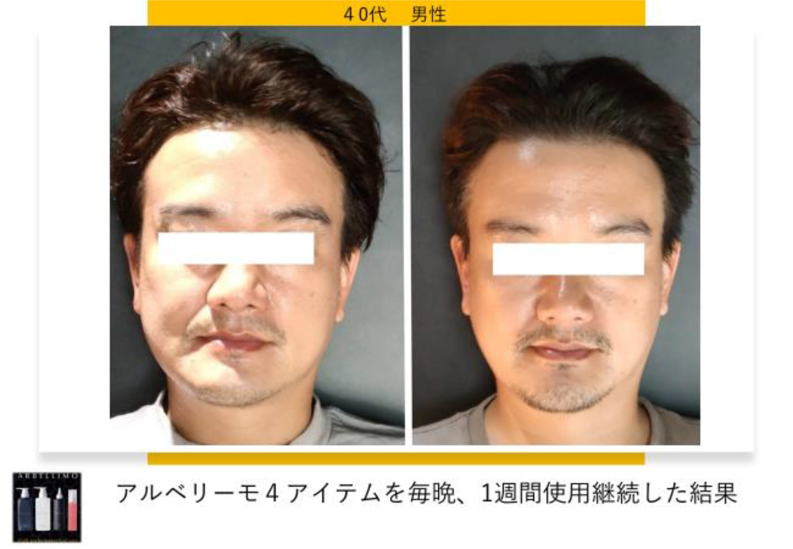 アルベリーモ,上がるシャンプー,エイジングケア,リフトアップ,スキャルプケア,育毛,養毛,LPS