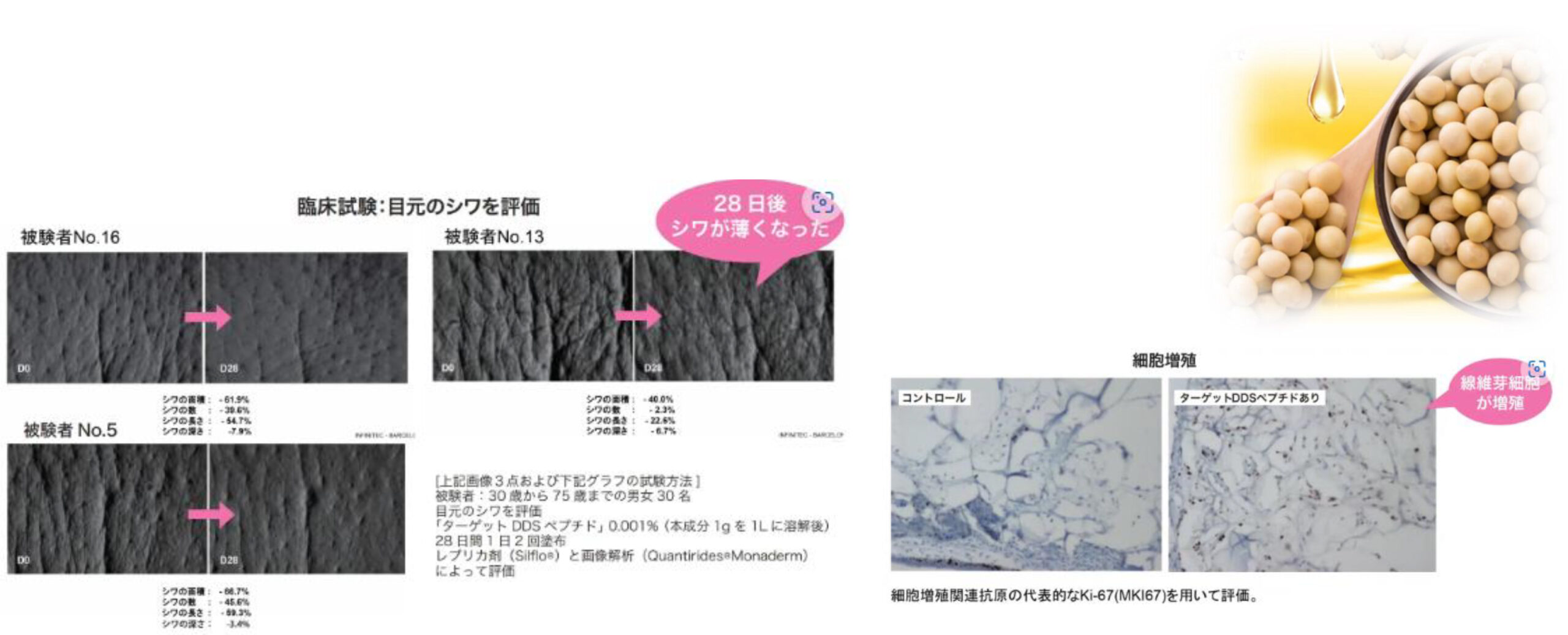 アルベリーモ,上がるシャンプー,エイジングケア,リフトアップ,スキャルプケア,育毛,養毛,LPS