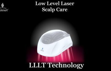 アイヘルメット,LLLT,育毛,薄毛対策,AGA対策,頭皮環境,頭髪DX