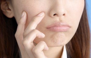 皮脂美容,22歳肌,オイルセラム22